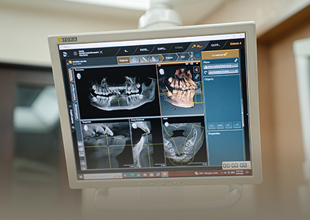 Dental Assesment