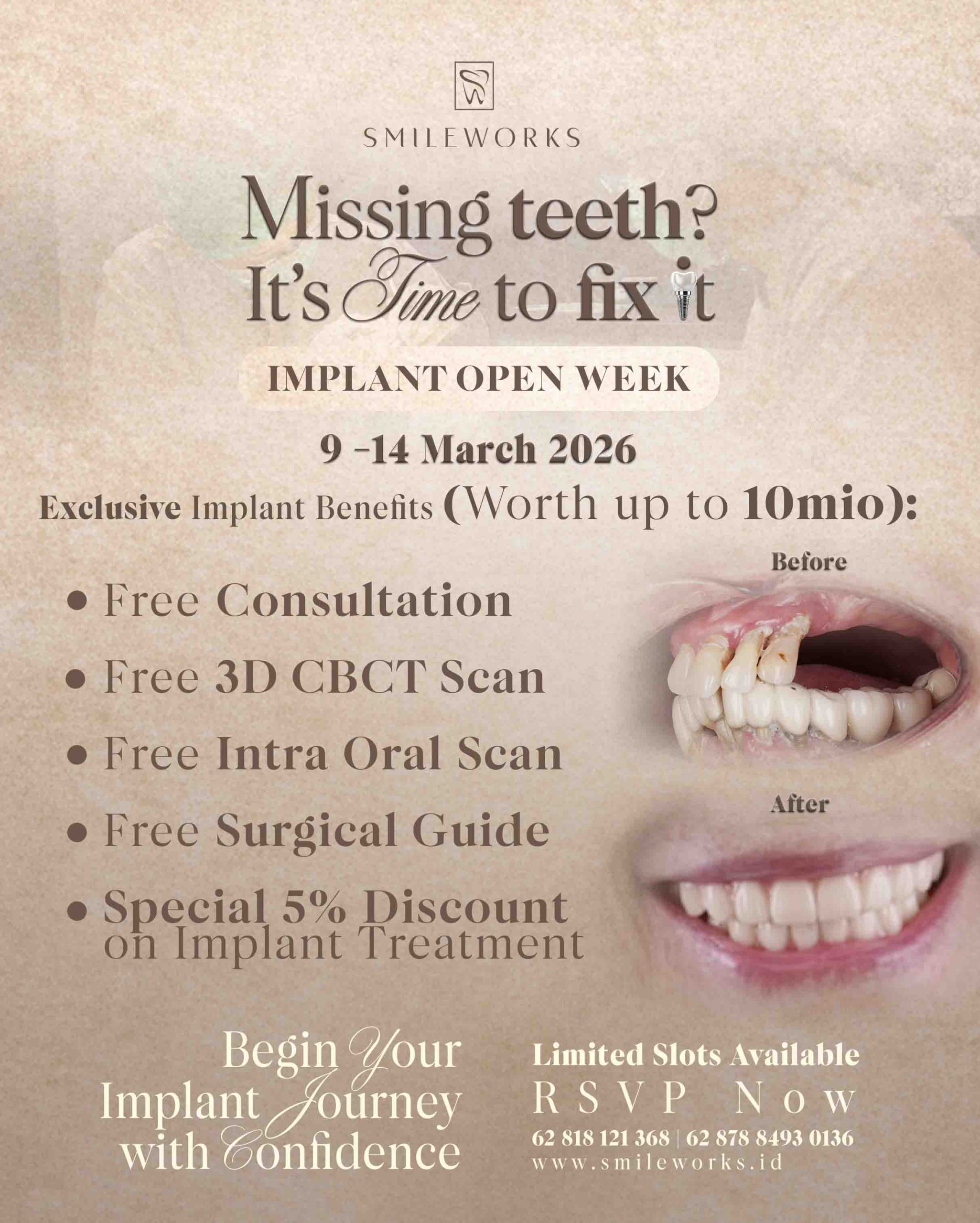 smileworks implant open week