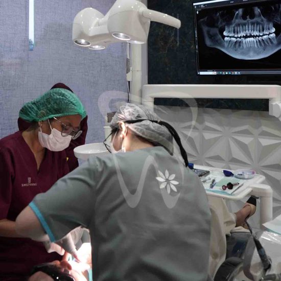 invisalign smilework