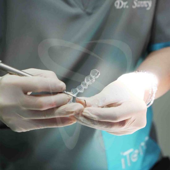 invisalign smileworks